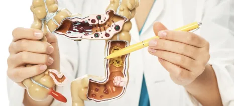 najbolji-probiotici-za-različita-stanja