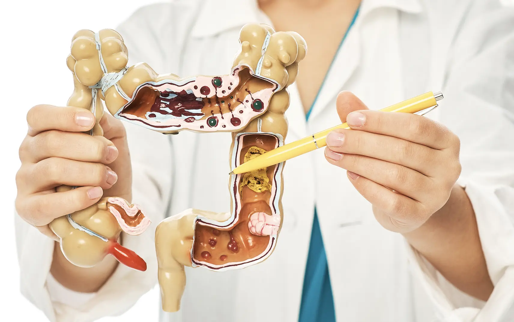 najbolji-probiotici-za-različita-stanja